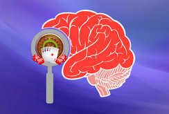 Причины, стадии и симптомы лудомании